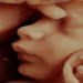 در دوران بارداری سونوگرافی سه بعدی چه اهمیتی دارد؟