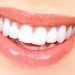 آشنایی با فلوئوروزیس دندانی