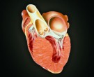 بیماری کاردیو میوپاتی (اختلال التهابی عضله قلب)