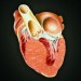 بیماری کاردیو میوپاتی (اختلال التهابی عضله قلب)