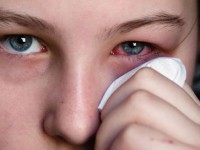 علل و علائم عفونت چشم چیست؟