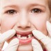 علت خراب شدن دندانهای شیری