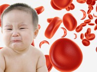 علل کم خونی کودکان
