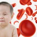 علل کم خونی کودکان