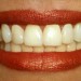 رابطه بین خرابی دندان و مصرف قند