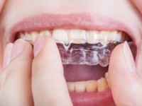 به کمک روشهای خانگی دندان قروچه را درمان کنید..!