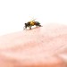 درمان سریع نیش زدگی زنبور عسل در منزل