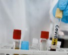 واکسن ویروس کرونا در چین موفقیت آمیز بود؟