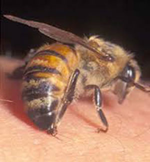 خطرات و عوارض زنبور گزیدگی و اقدامات درمانی جهت آن