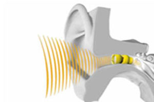 ۶ راه حل برای پیشگیری از افت شنوایی