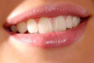 آیا دندان هایتان حالت لقی دارند؟