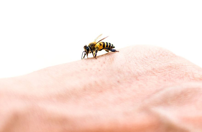درمان سریع نیش زدگی زنبور عسل در منزل