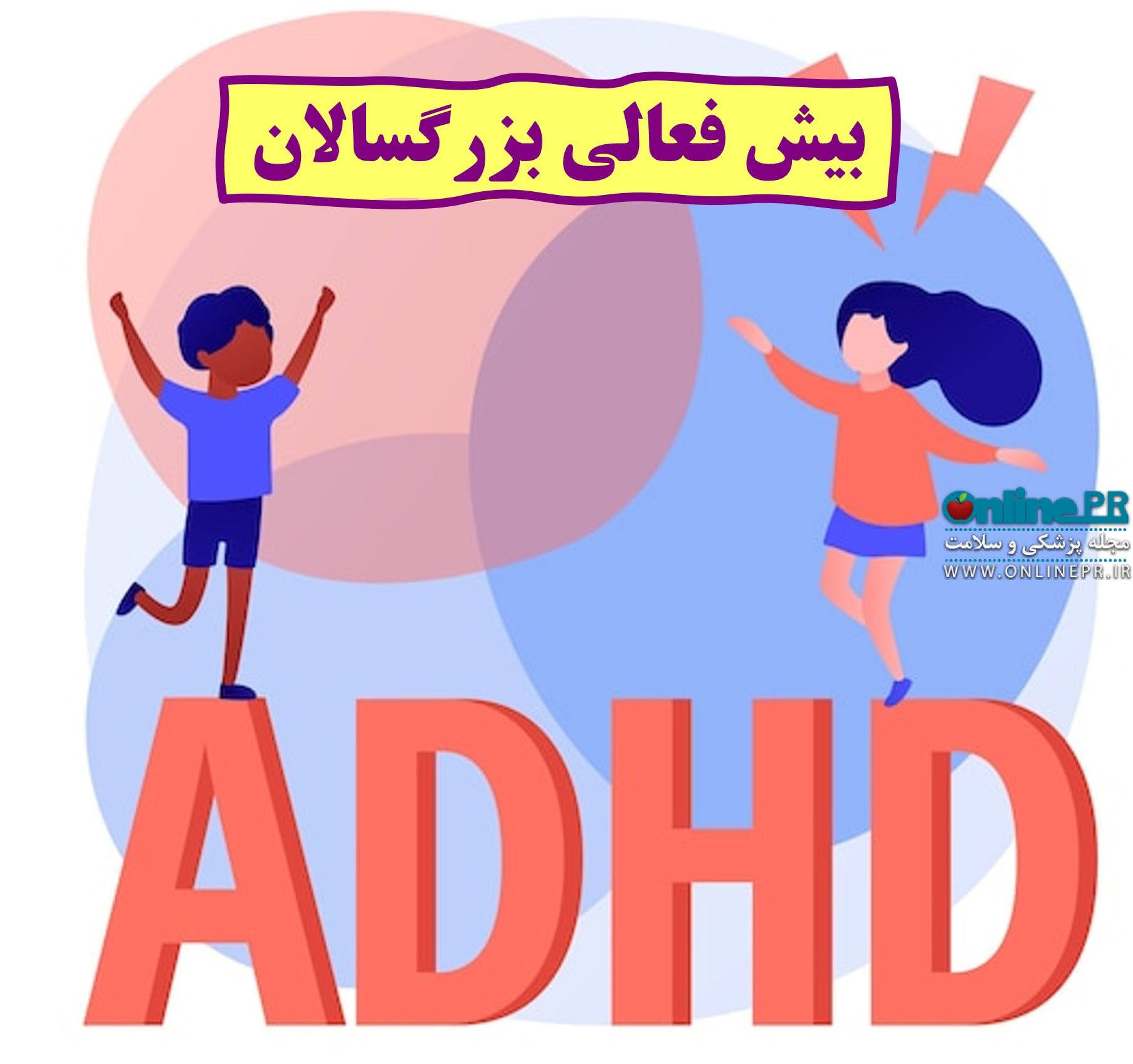 درمان adhd (بیش فعالی) در بزرگسالان